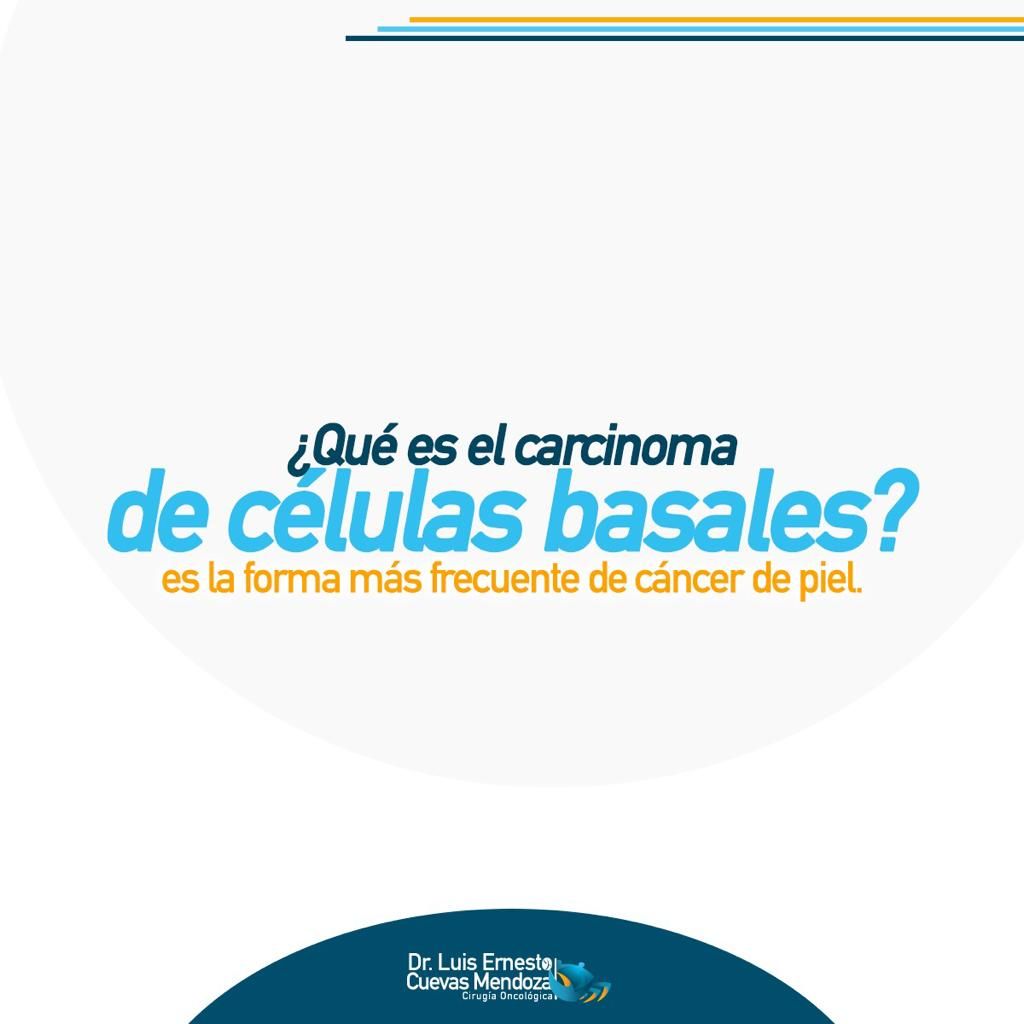 Luis Ernesto Cuevas Mendoza-174