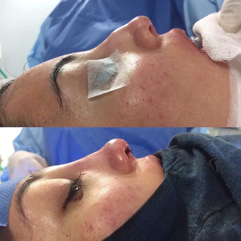 Romana Ramos Cárdenas-50