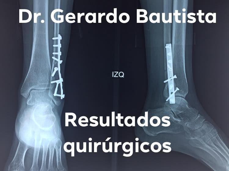 Gerardo Bautista Díaz-2