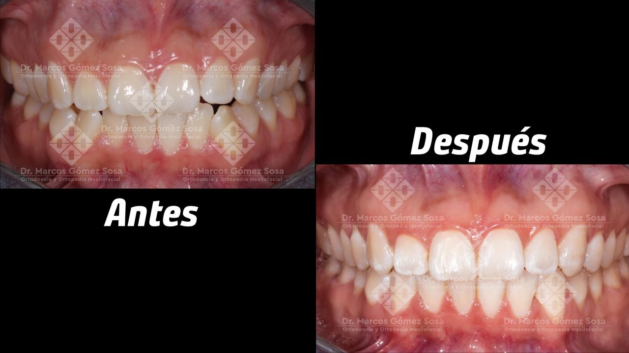 Marcos Gómez Sosa-7