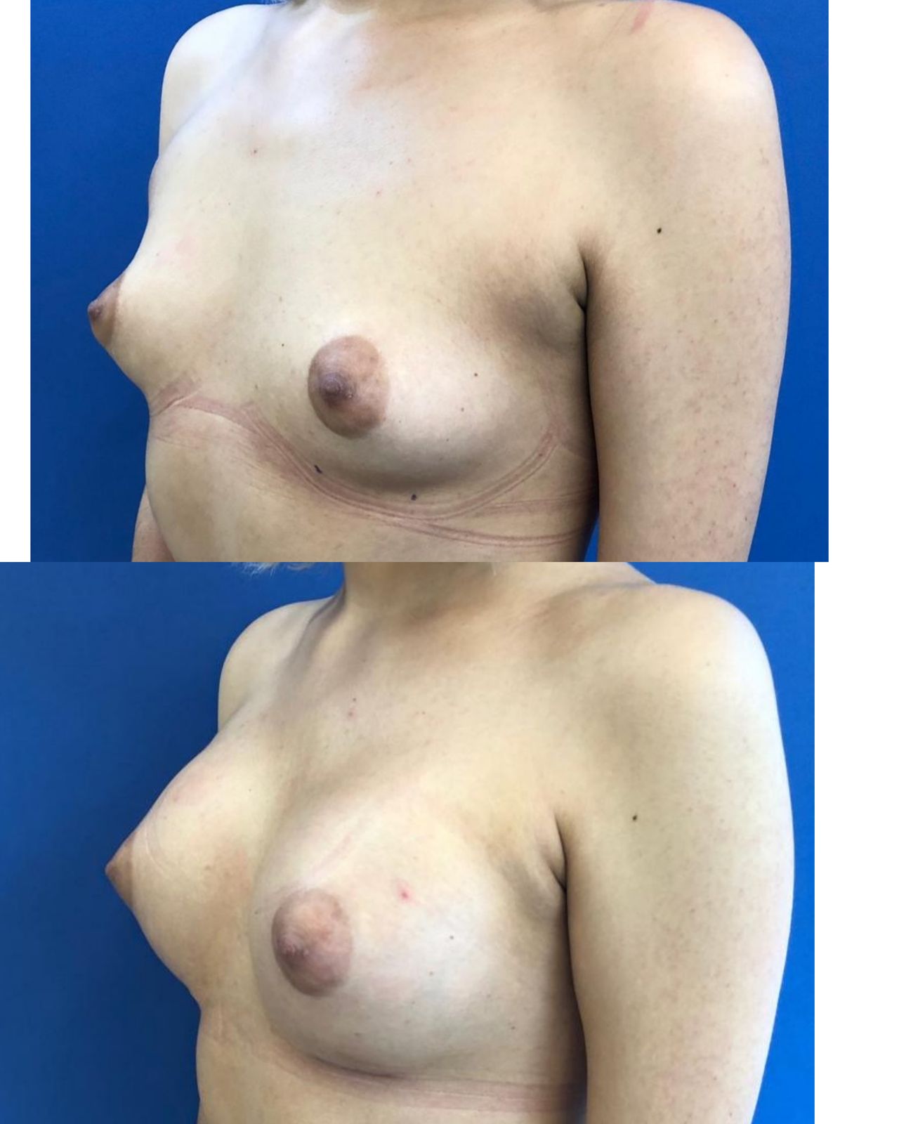 Giuseppe Tanzillo-59