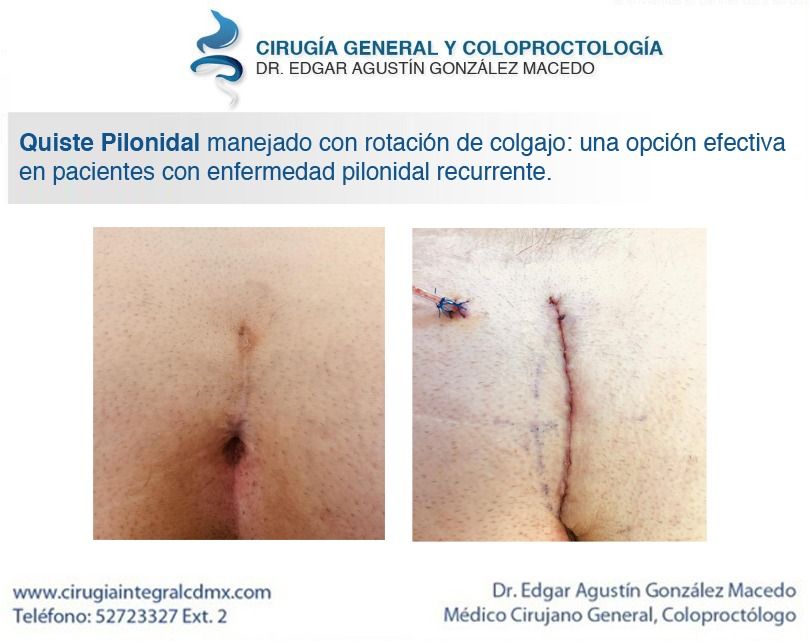 Edgar Agustín González Macedo-15