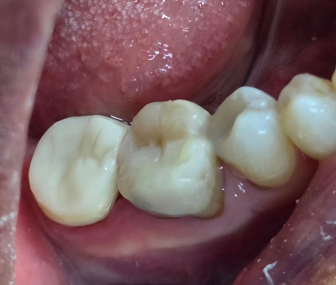 Edgardo Caballero Dávila-19