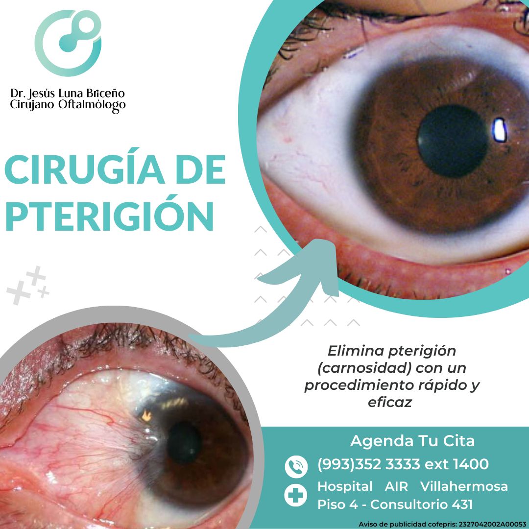 Jesus Luna Briceño-4