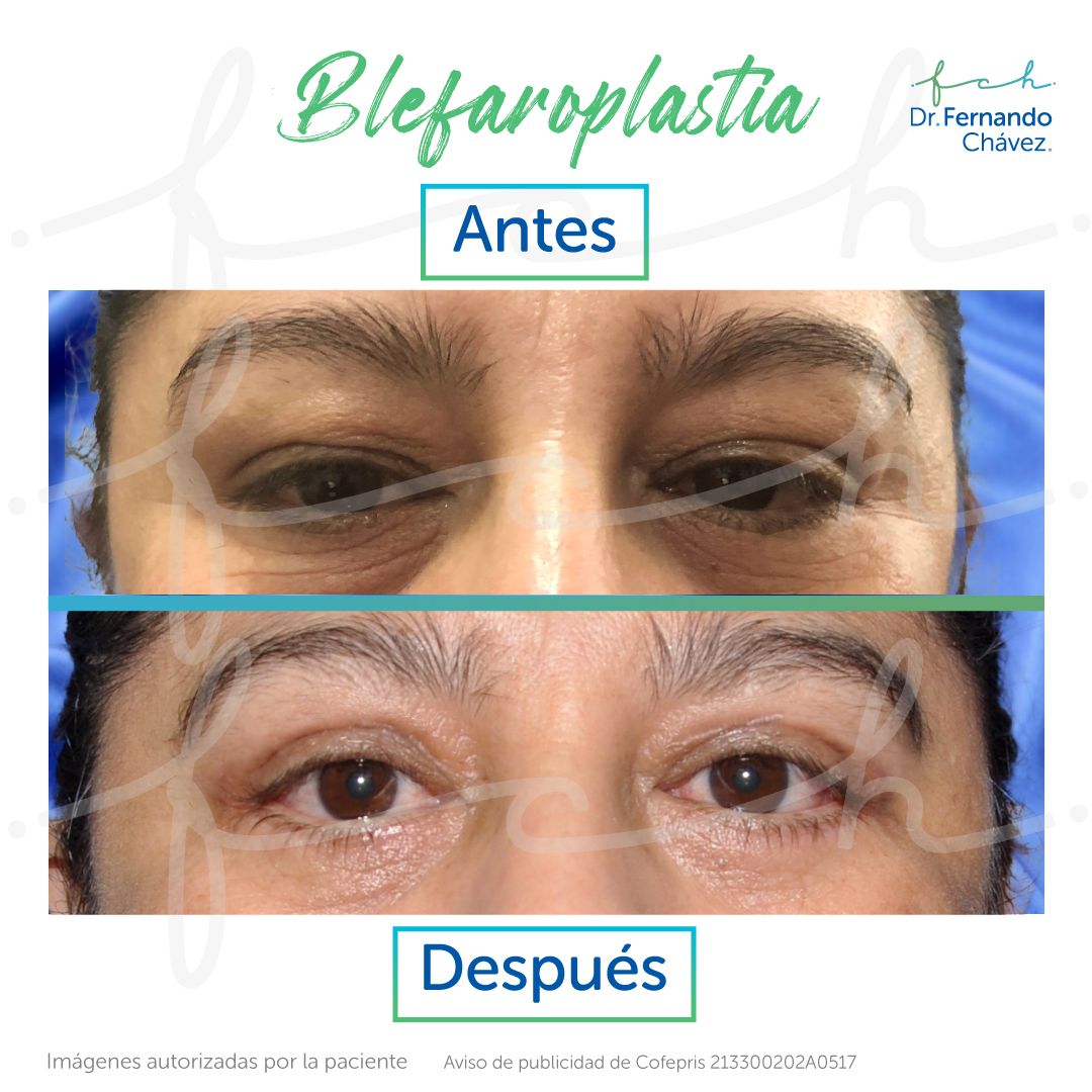 Fernando Chávez Osorio-14