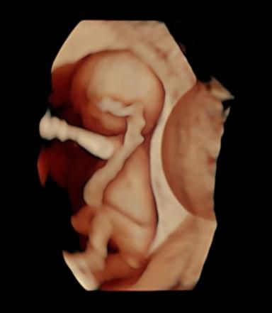 Katia Yareli Viera Ibarra-13