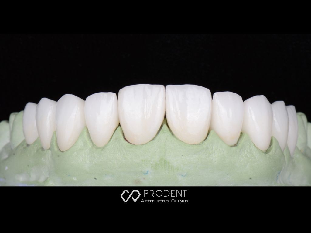 Ramiro Ivan Pérez Murillo-56