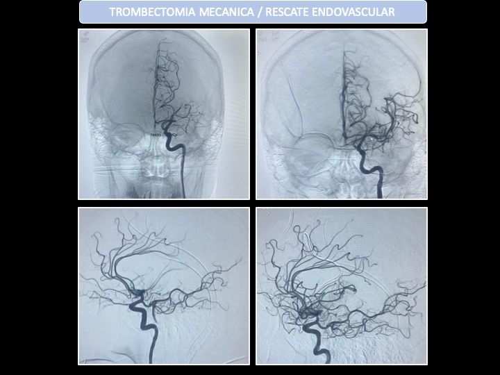 José De Jesús Gutiérrez Baños-53