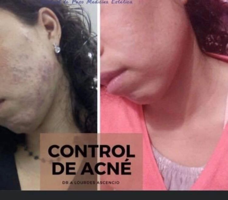 Maria De Lourdes Ascencio García-36