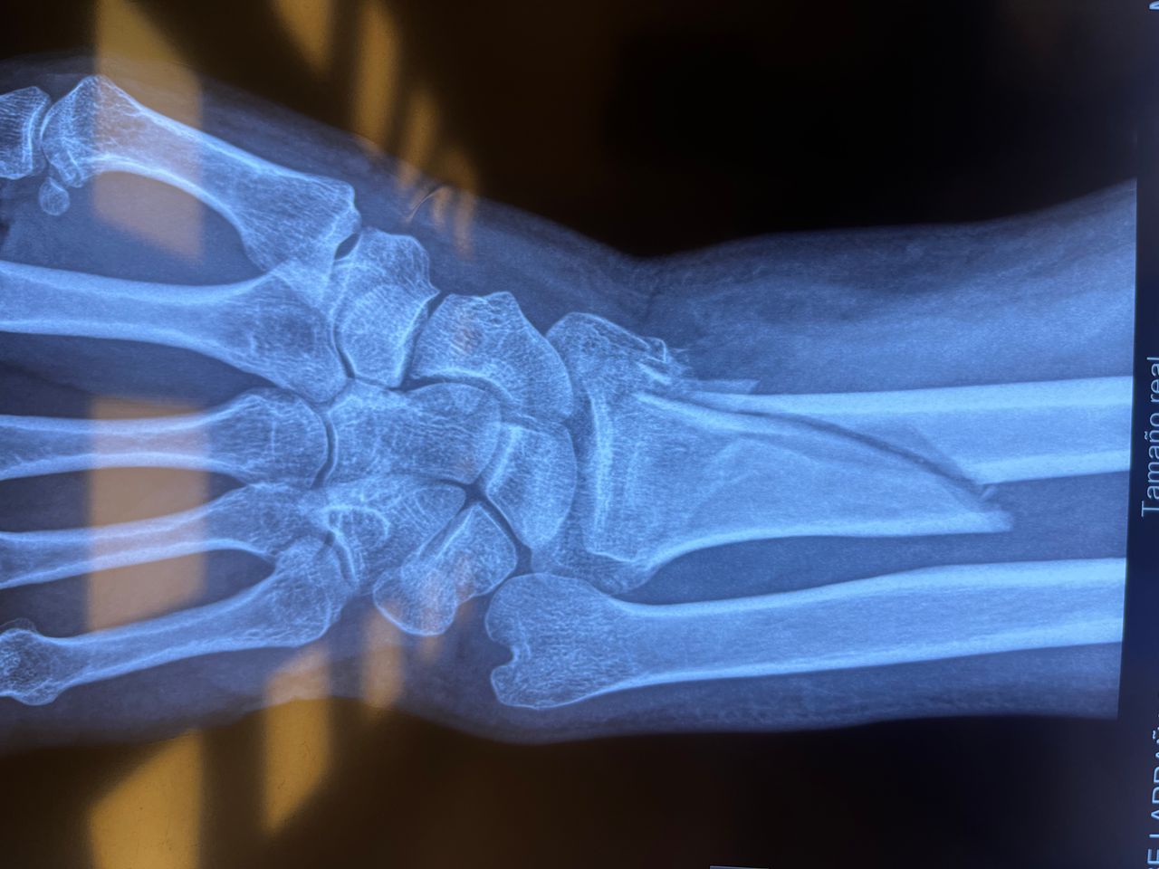 Alberto Lorenzo Cortés-2