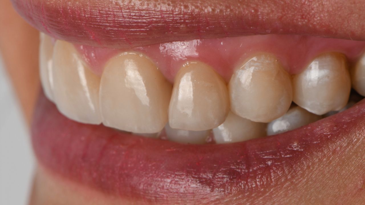 Ricardo López Lemus-81