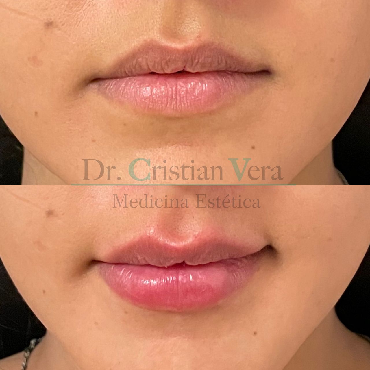 Cristian Eduardo Vera Nuño-11