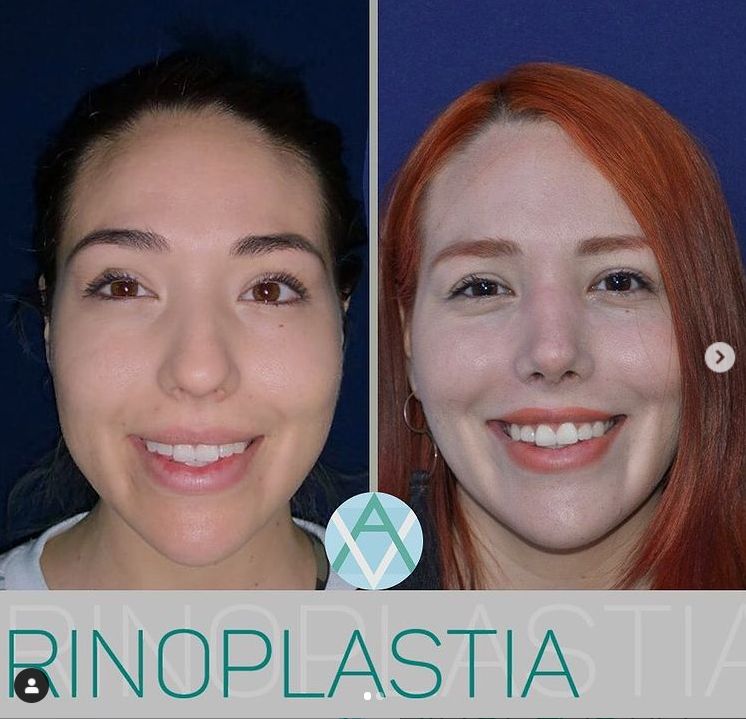 Alfonso Villaseñor Herrero-10