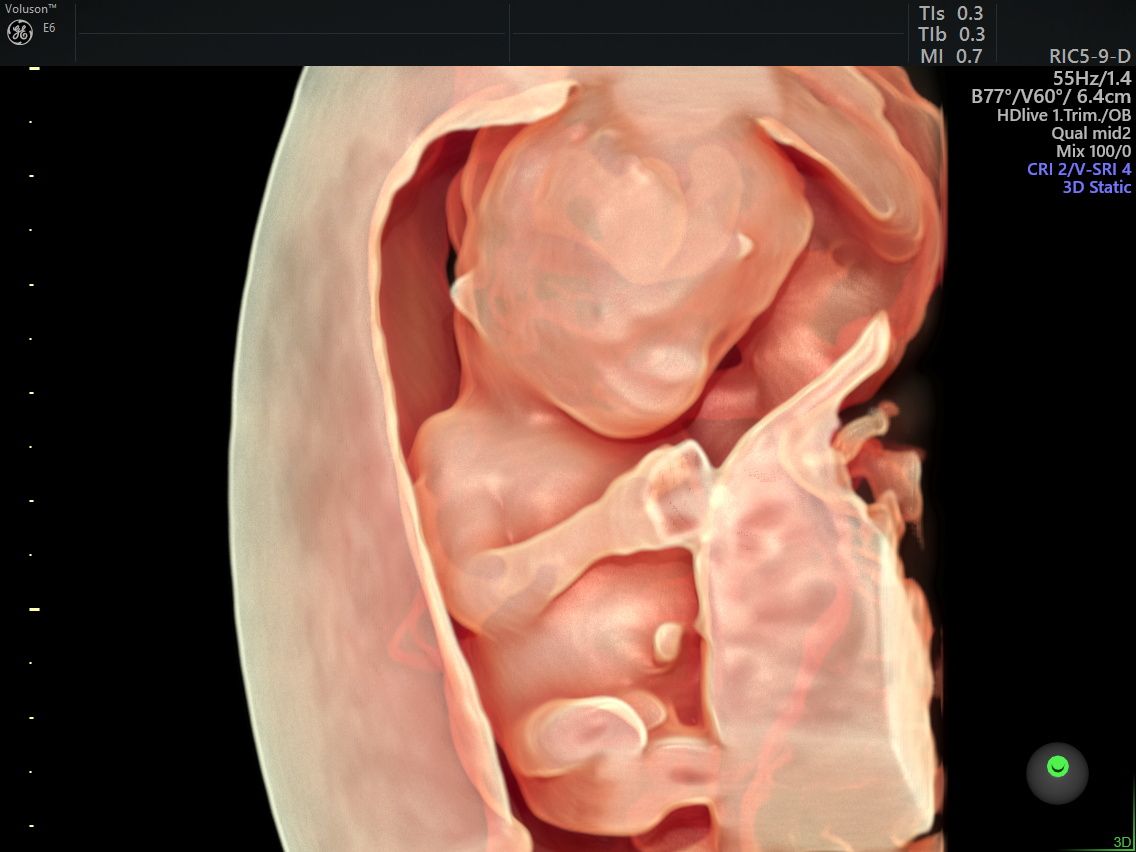 Gila Lili Barrientos Chavez-7