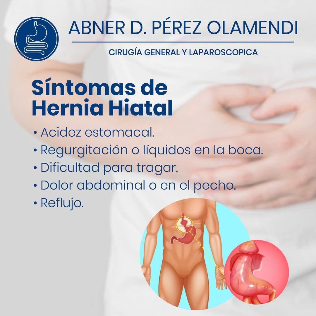 Abner Daniel Pérez Olamendi-17