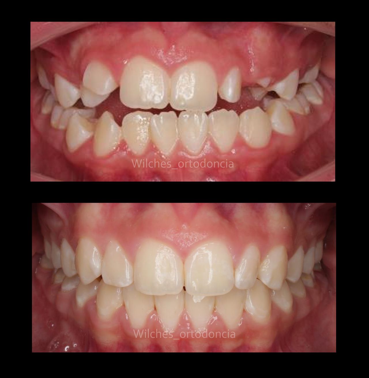 Luis Alberto Wilches Vergara-3