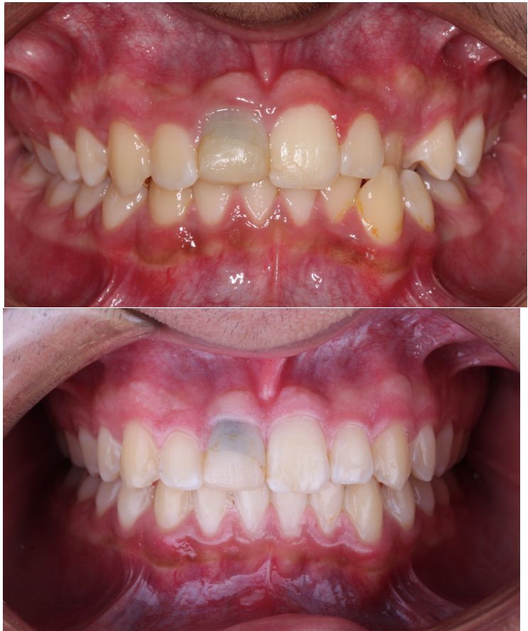 José Luis Pérez Vázquez-0