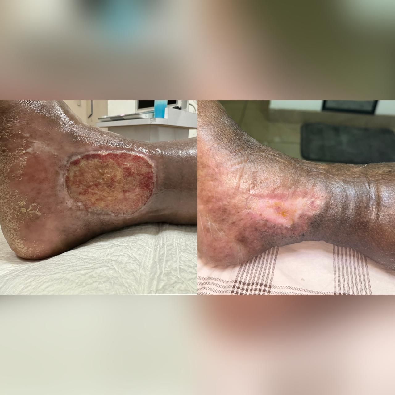 Jhonatan López González-11