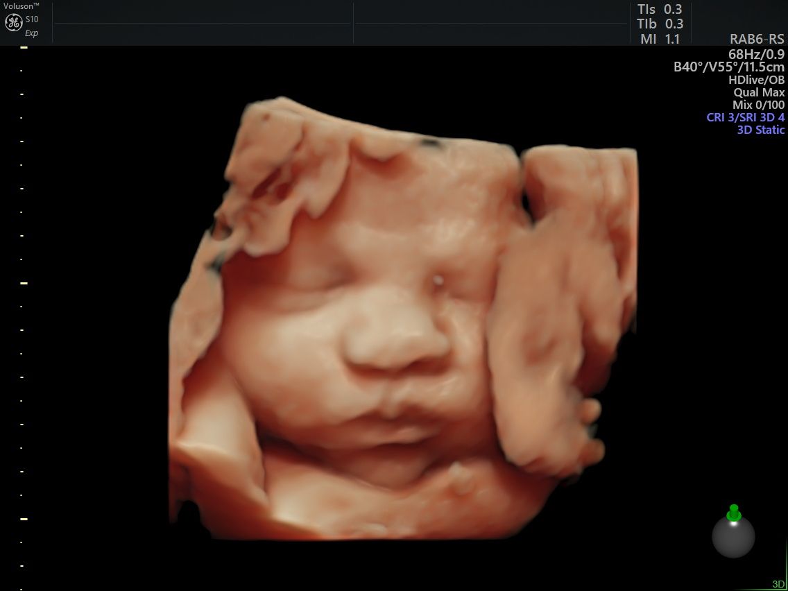 Arturo Herrera Flores-10