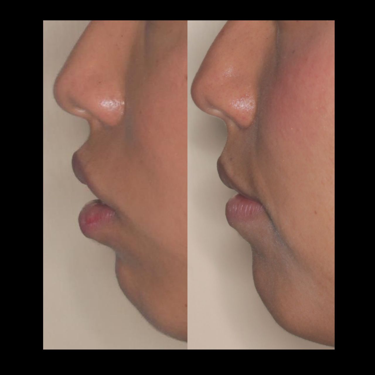 Luis Alberto Wilches Vergara-6