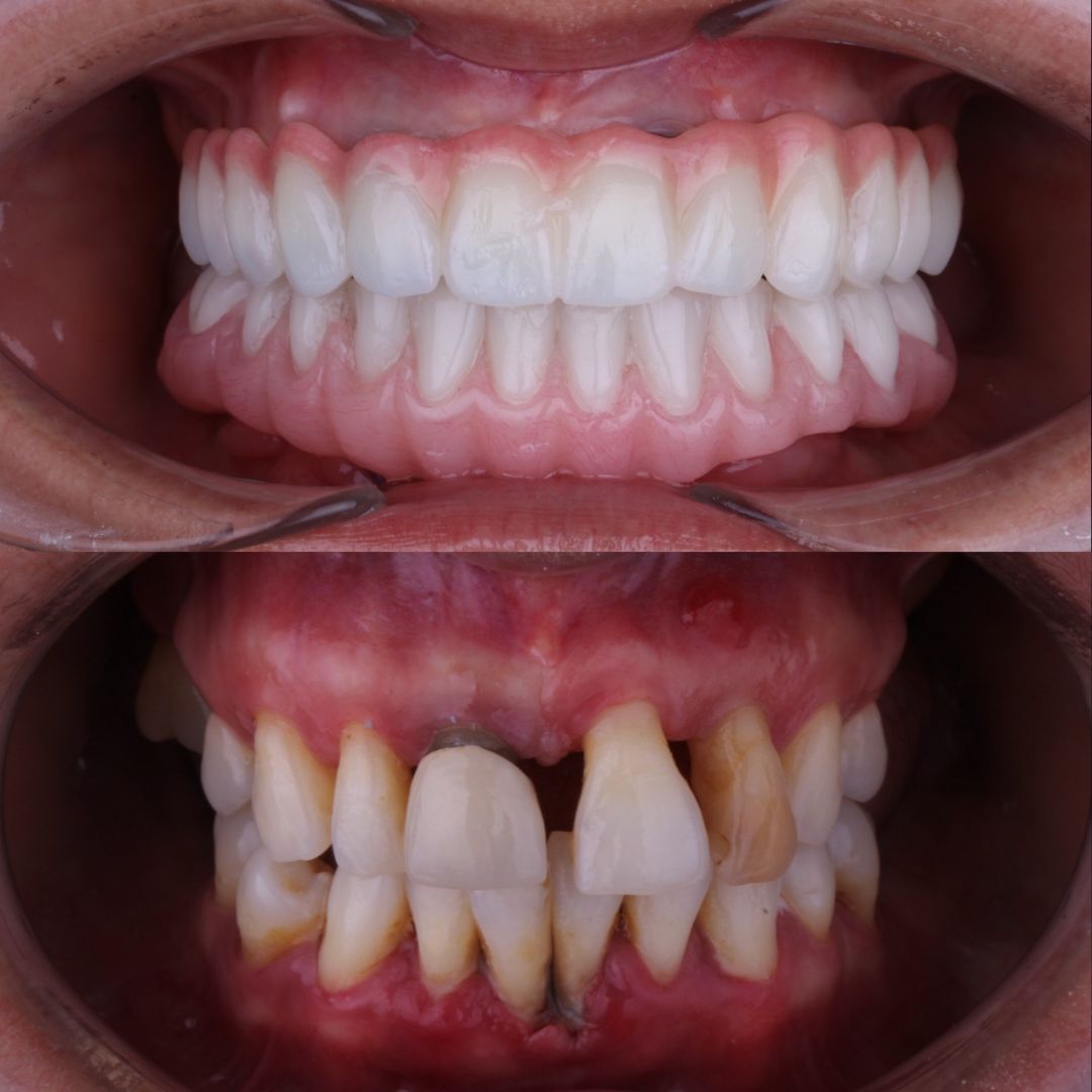 Arturo Mendez Valencia-33