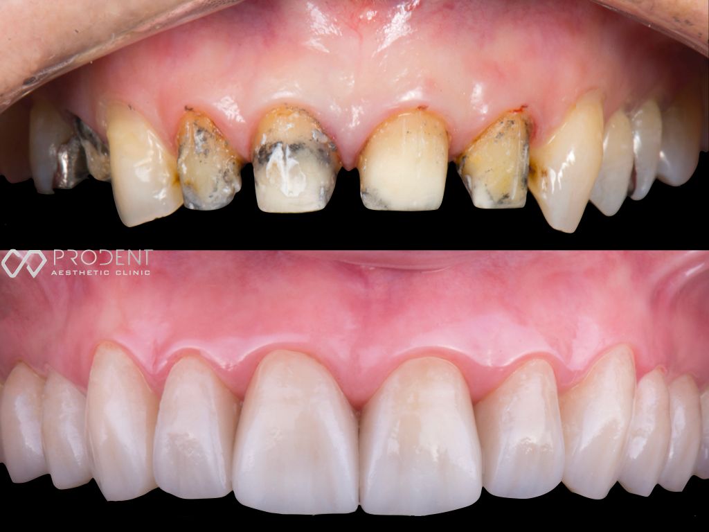 Ulises Pérez Murillo-71