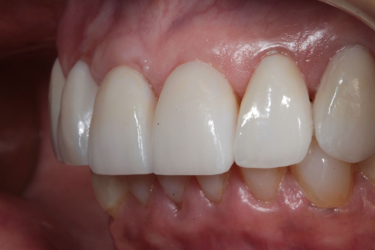 Mariel Itzayani Torres López-43