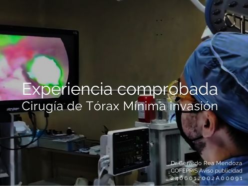 Gerardo Rea Mendoza-22