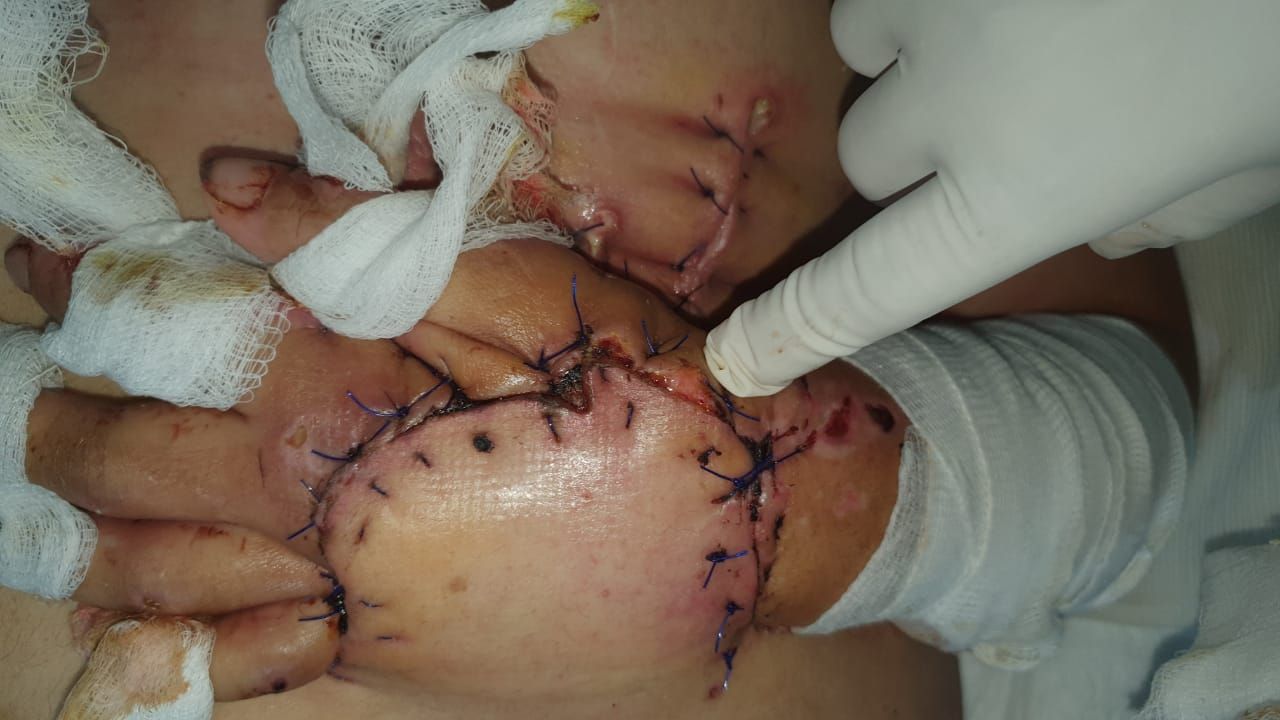 Federico Quintana De La Rosa-50