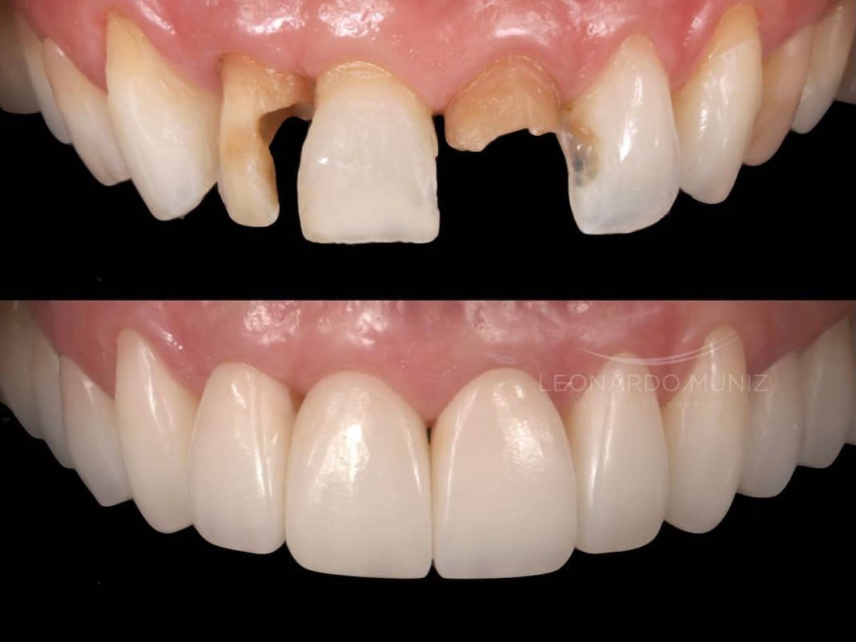 Ernesto Rojas Calderon-38