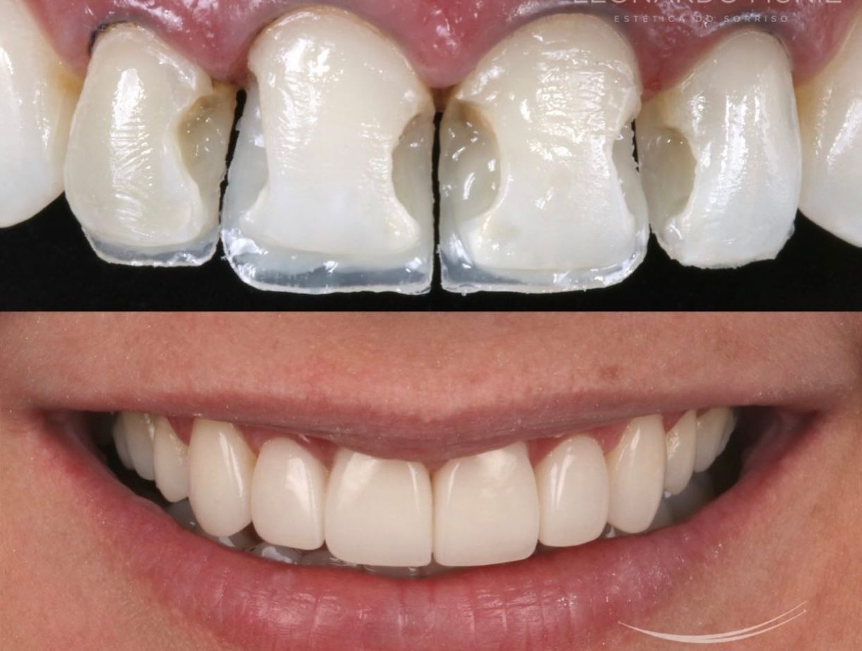 Ernesto Rojas Calderon-36