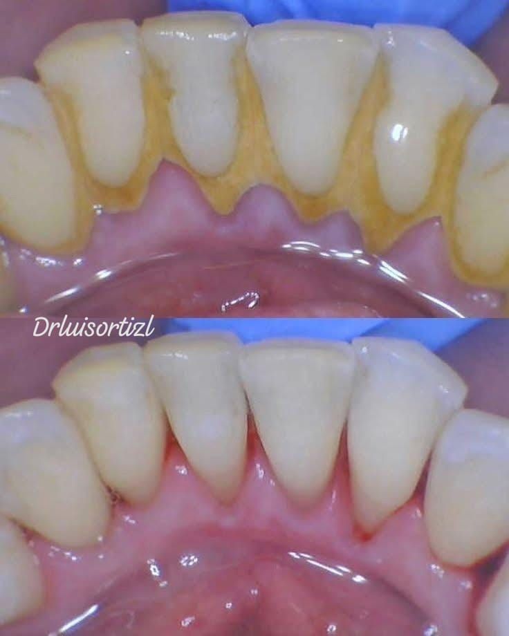 Luis Ángel Ortiz López-24