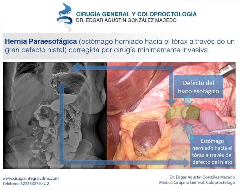 Edgar Agustín González Macedo-13