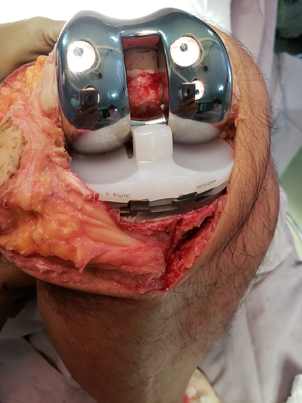 Moises Moreno Martinez-3