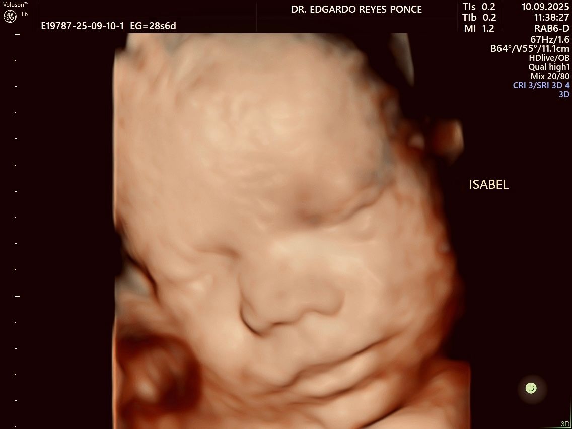 Edgardo Reyes Ponce-1