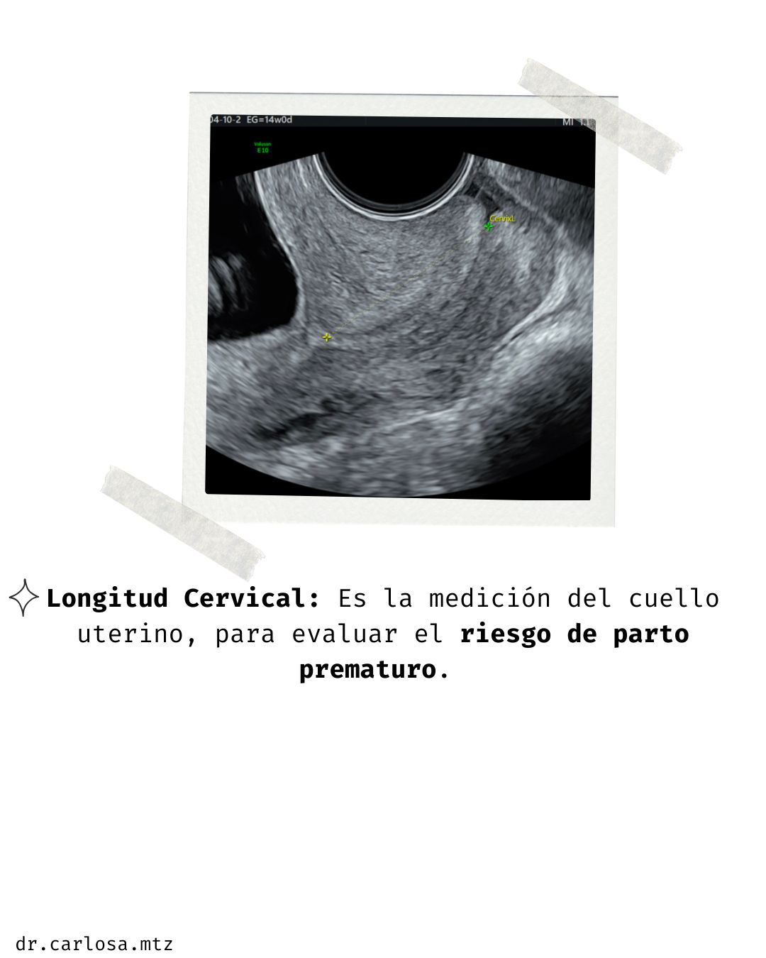 Carlos Arturo Martínez Méndez-17