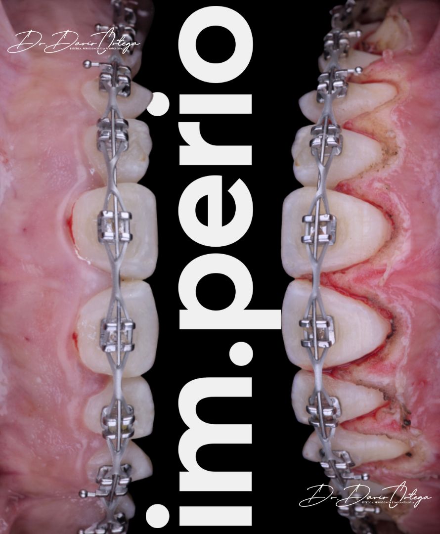 Dario Ortega Aceves-18