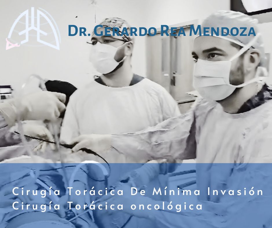 Gerardo Rea Mendoza-42