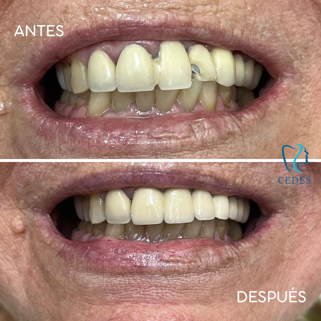 Consuelo Chapa Garza-10