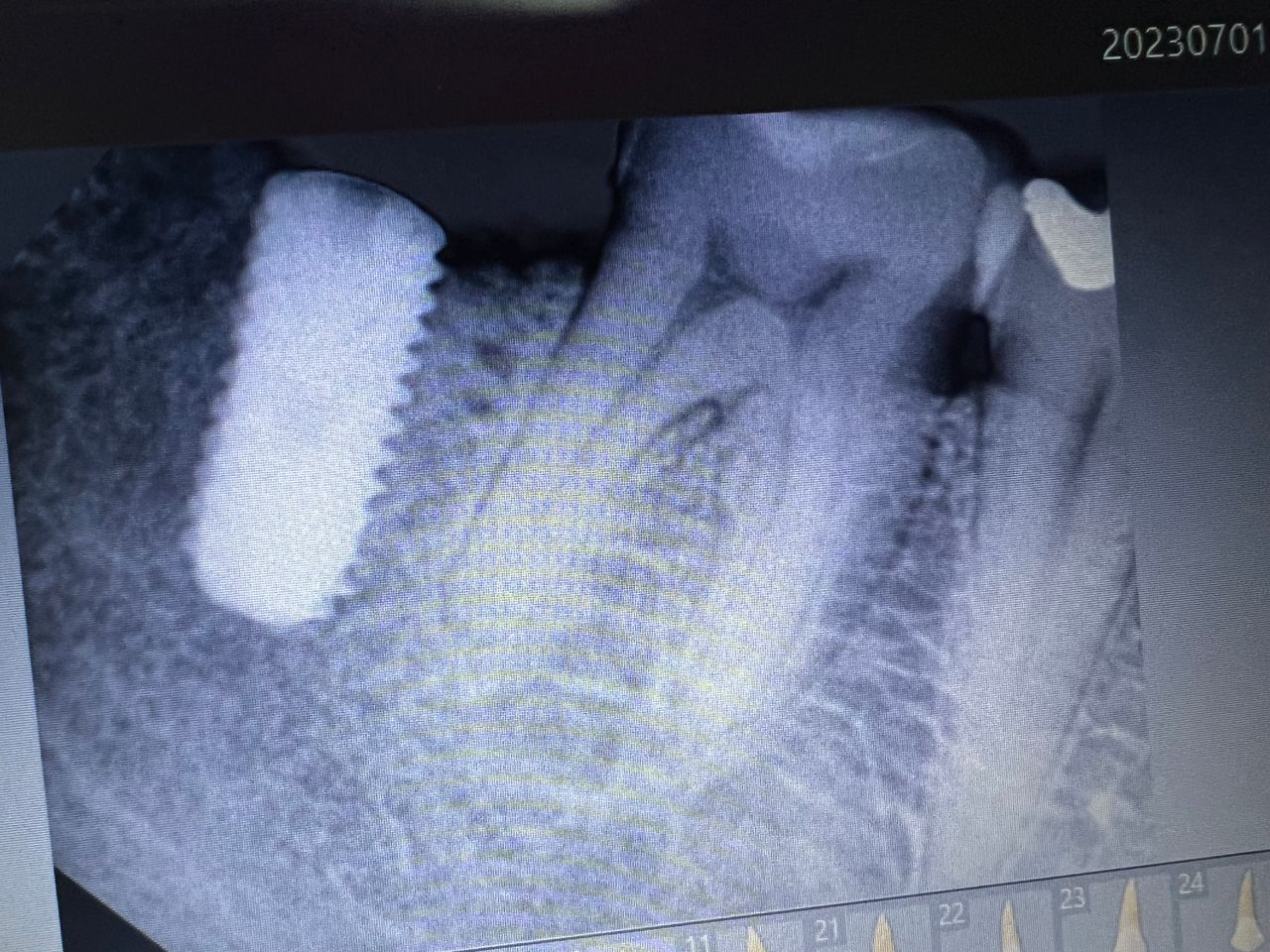 Luis Angel Carranza Resendez-3