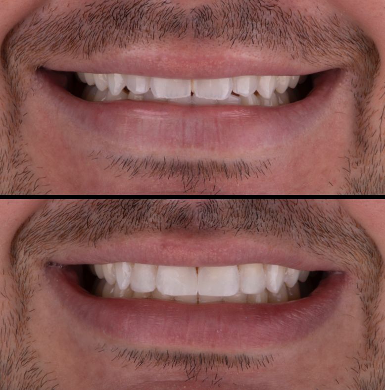 María Fernanda González Gastelum-27