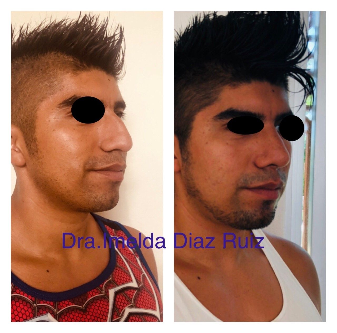 Imelda Díaz Ruiz-17