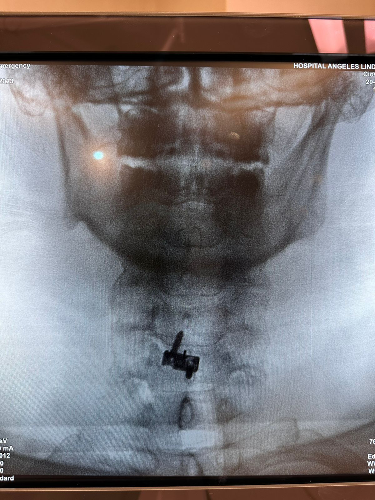 Gerson Reyes Rodríguez-35