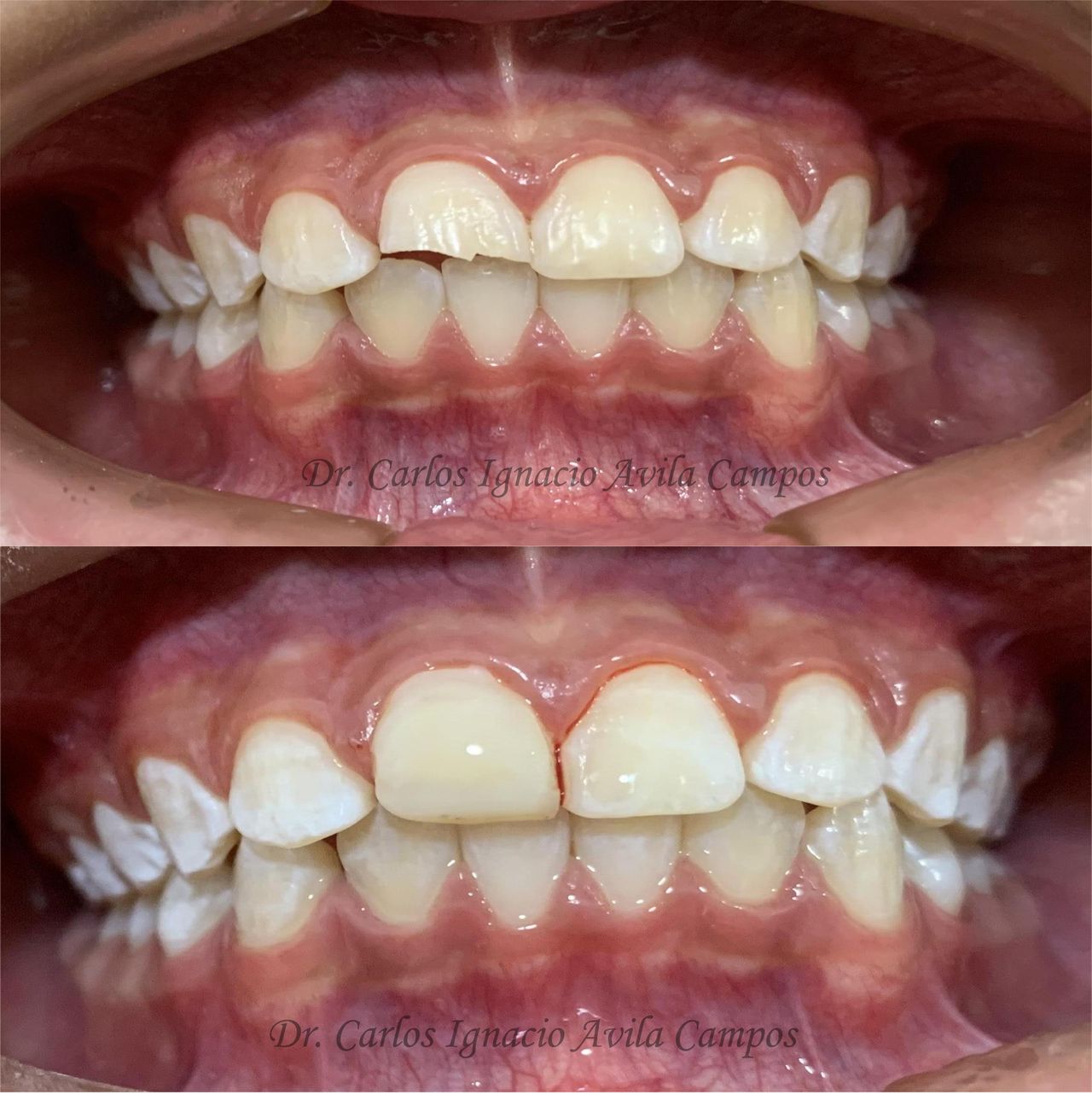 Carlos Ignacio Avila Campos-12