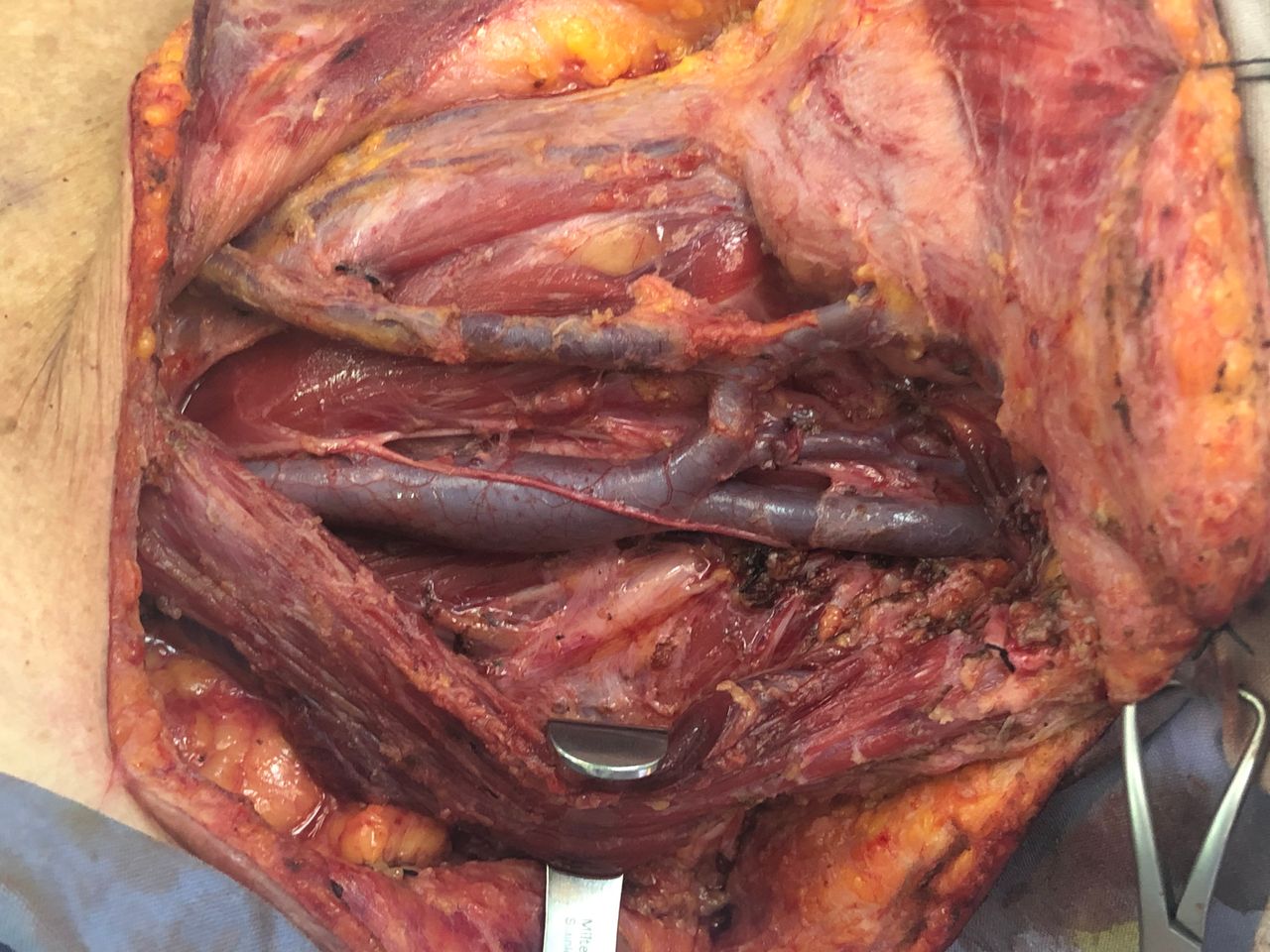 César Espejel Valdés-36