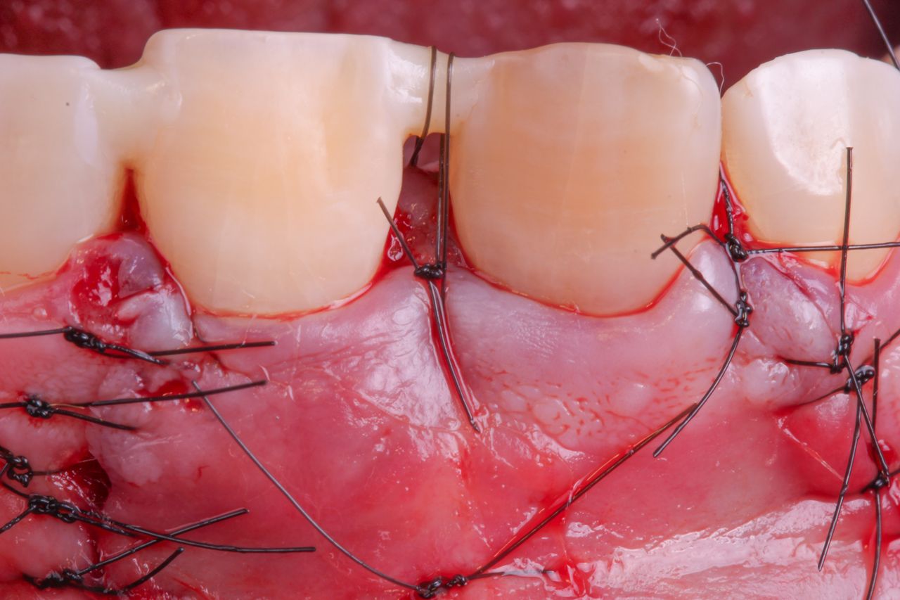 Hugo Enrique Aguilar Lamas-79