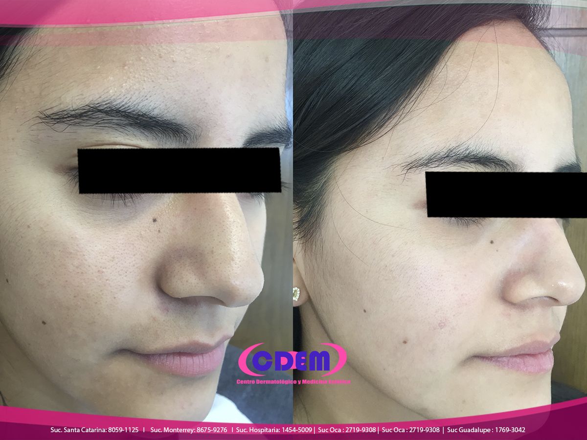 Mercedes Fernández Reyes-17