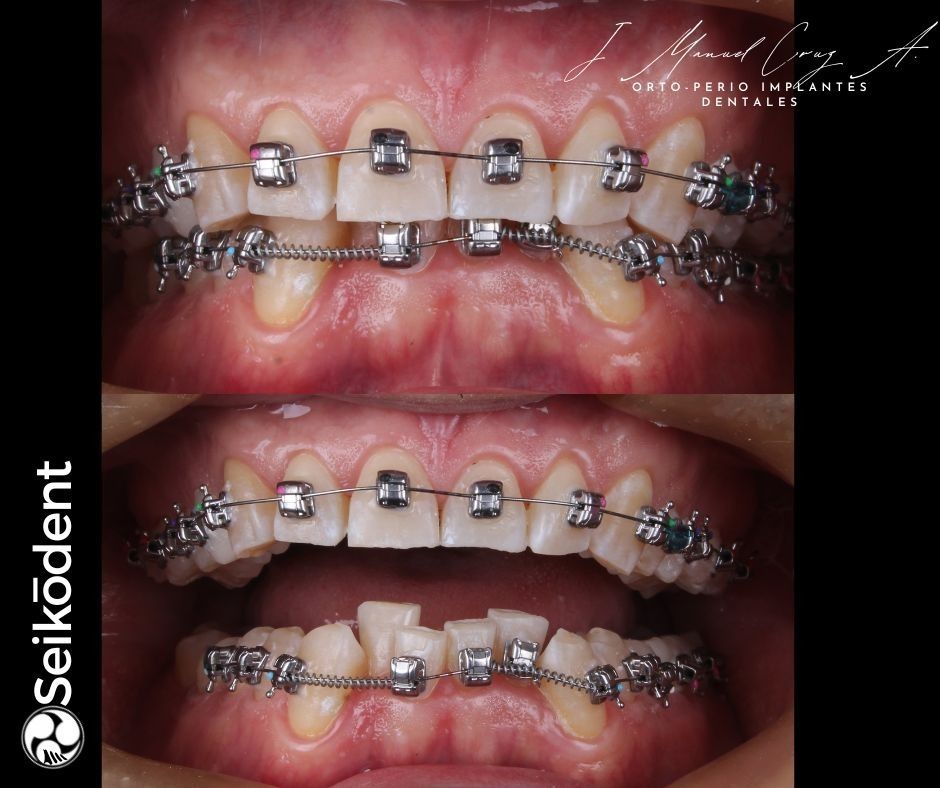 Juan Manuel Cruz Arredondo-3