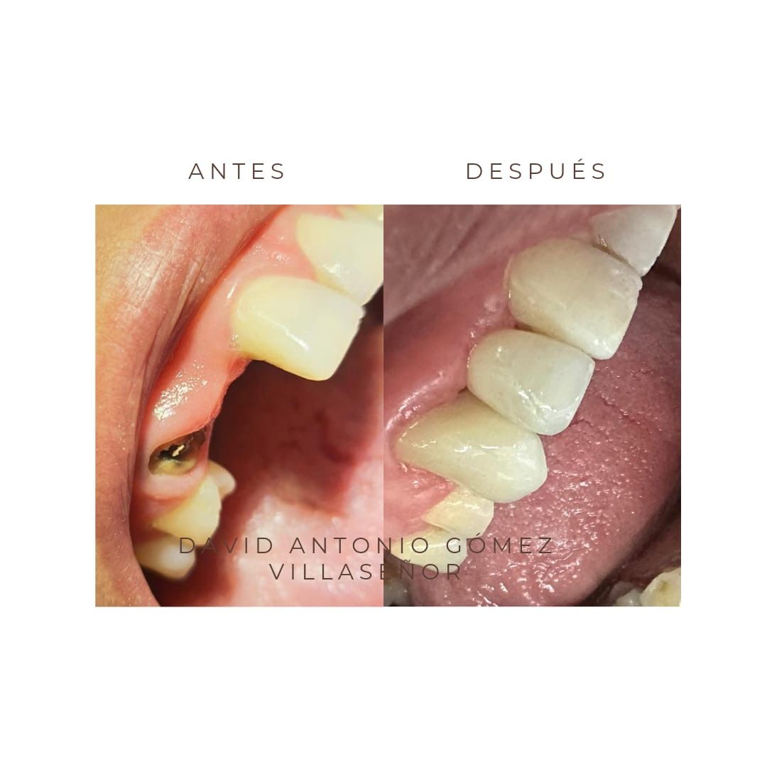 David Antonio Gómez Villaseñor-3