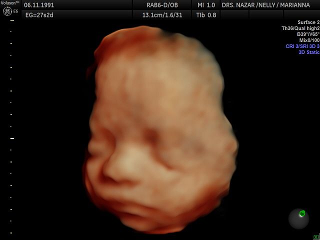 Miguel Angel González Nazar-15